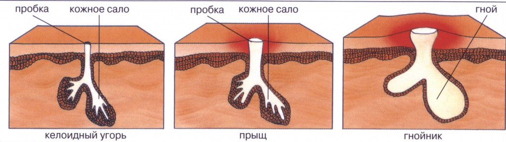 Специфические заболевания кожи: классификация, причины, лечение, фото1