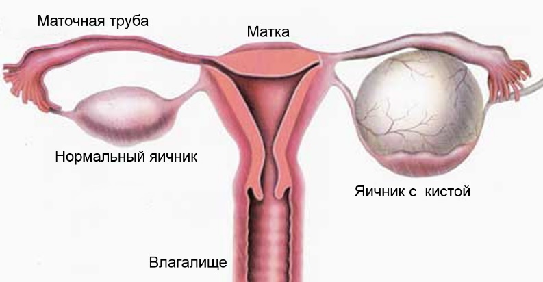 Почему после секса болит влагалище, яичник: причины, лечение, последствия1
