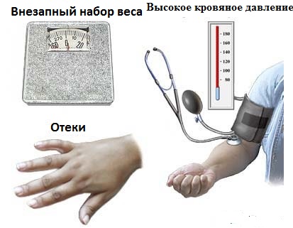 Гестоз при беременности: симптомы, лечение1