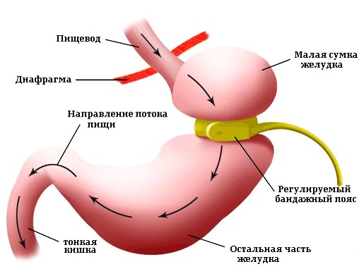 Рак поджелудочной железы: симптомы, проявления, лечение24