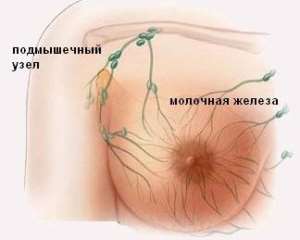 Что делать, если болит грудь?2