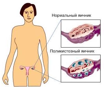 Болит низ живота у женщины, что делать?2