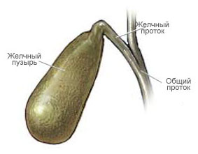 Острый и хронический холецистит: симптомы, лечение2