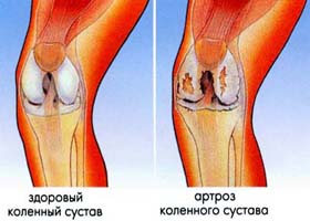 Почему болят ноги после сна?2