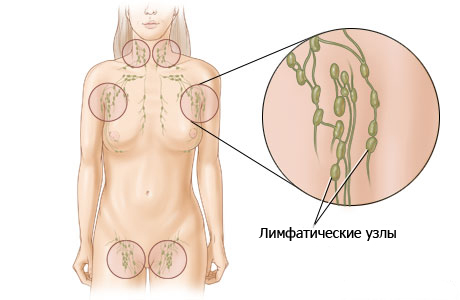 Острый и хронический пиелонефрит2