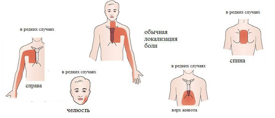 Болит сердце, что делать в домашних условиях?2