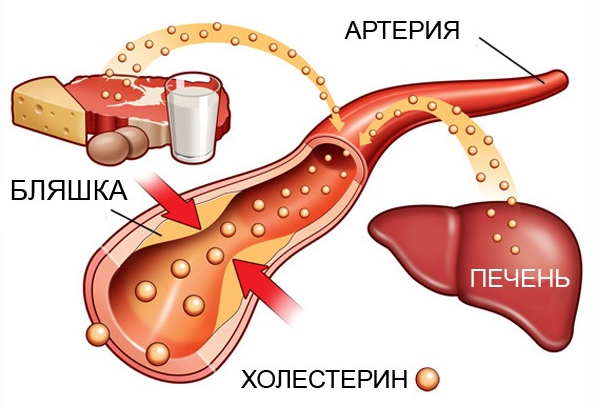 Как снизить холестерин в крови в домашних условиях, народными средствами2