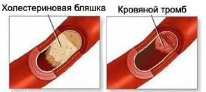 Почему болят ноги ниже колен: причины, заболевания, лечение2