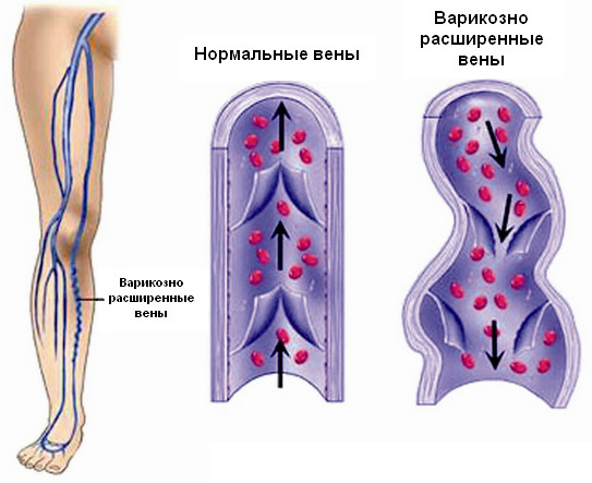 Что такое вредная пища? Проблема ожирения в Мире2