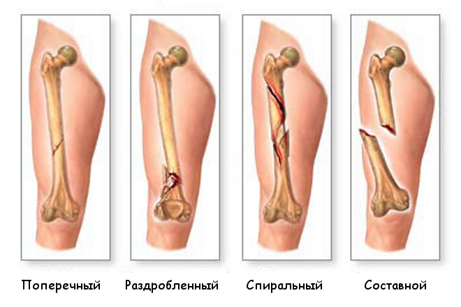 Первая медицинская помощь при травме. Все виды травм3