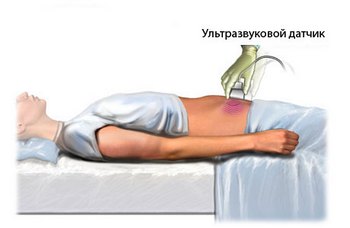 Ультразвуковая диагностика простаты3