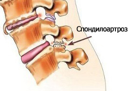 Почему болит спина в пояснице 3