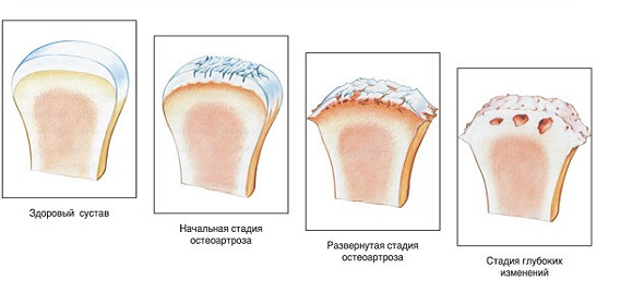 Болят кисти рук, что делать?3