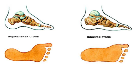 Сильно болят ноги, что делать?3
