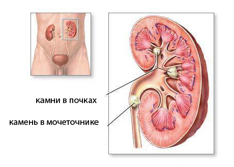 Коматозные состояния у детей. Неотложная помощь3