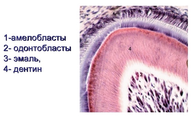 Изменение цвета эмали. Дефекты, связанные с нарушением образования дентина3