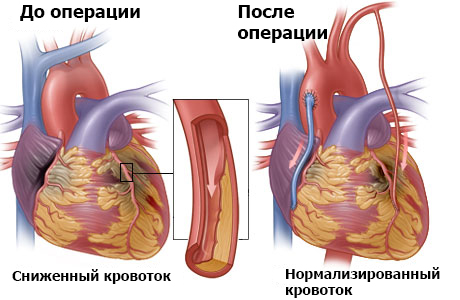 Хирургическая эндодонтия. Техника наложения швов 3