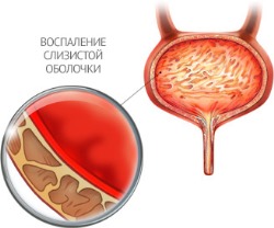 Почему при сексе болит бок: причины, лечение, последствия3
