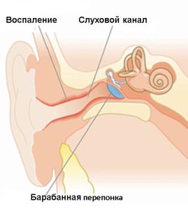 Вульвит у девочек: причины, симптомы, лечение3