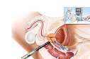 Ультразвуковая диагностика простаты