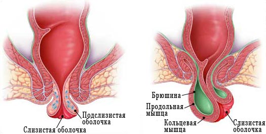 Как передается сифилис, анализ крови на сифилис3