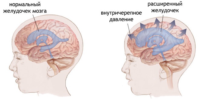 Конъюнктивит у детей: лечение, симптомы,  профилактика, фото4