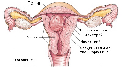 Гиперплазия эндометрия: симптомы, лечение, отзывы, фото4