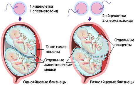 Асфиксия новорожденного: степени, реанимация, последствия4