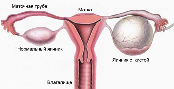 Что делать, если болит низ живота?4