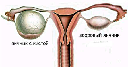 Почему после секса болит живот?4