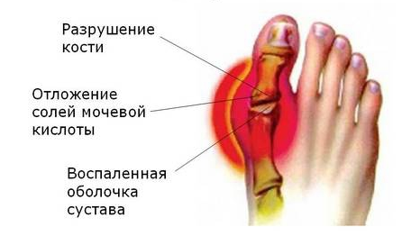 Болят кисти рук, что делать?4