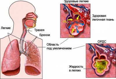 Отравления производными карбаминовой кислоты 4