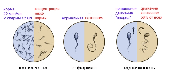 Беременность после лапароскопии 4