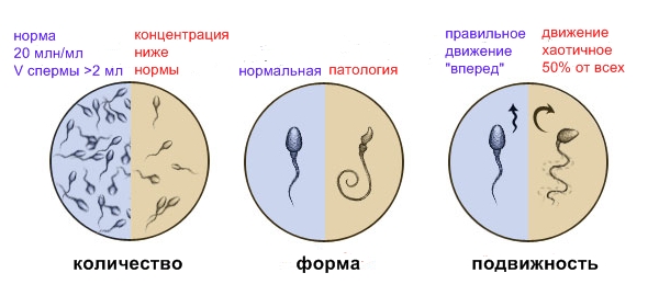 Беременность после лапароскопии 4