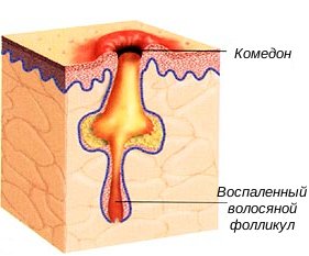 Ферментативная антиоксидантная система: методика, показания, фото4