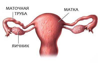 Гидросальпинкс: симптомы, лечение, операция4