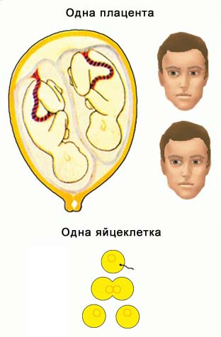 Тетрада Фалло: описание, диагностика, методы лечения, рекомендации врачей4