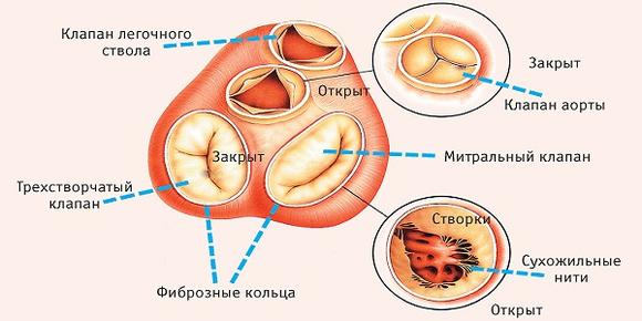Операция на митральном клапане сердца4