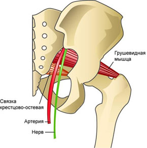 Боль в копчике: причины, лечение, боли при сидении, при вставании4