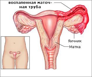 Что делать, если болит бок?5