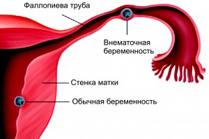 Что делать, если болит низ живота?5