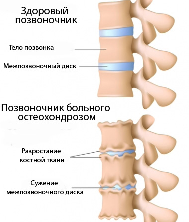 Почему болит грудь после месячных?5