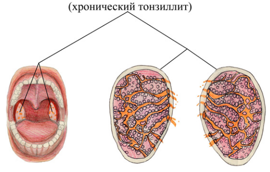 Ребёнок часто болеет5