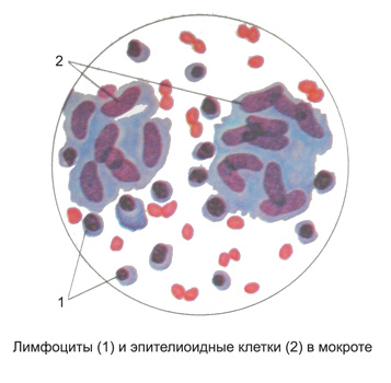 Острое воспаление кожи: виды, диагностика, лечение, фото5