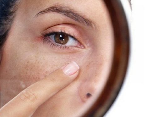 Сосудистые лазеры. Удаление пигментных пятен лазером, отзывы, цена5