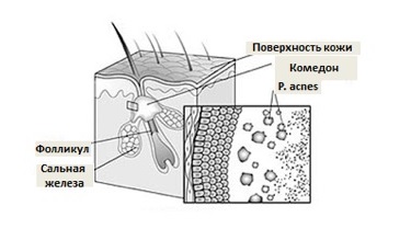 Специфические заболевания кожи: классификация, причины, лечение, фото5