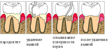 Стоматологический анамнез: содержание, заболевания, способы лечения5