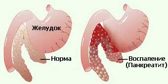 Почему болит желудок при беременности 5