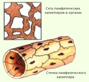 Лимфостаз нижних конечностей: лечение, симптомы, причины, фото6