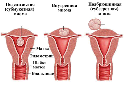 Болит желчный, что делать?6